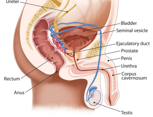 IT Prostatitis