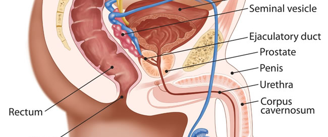 Prostatitis